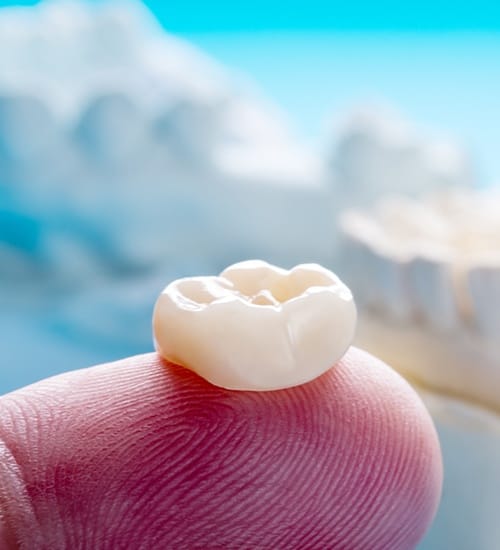 Dental crown restoration resting on a finger tip