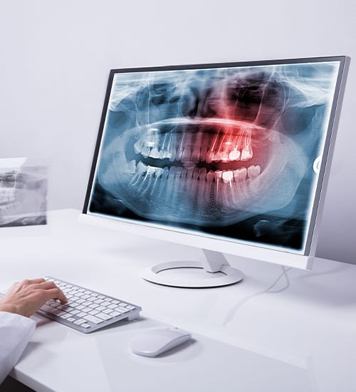 Dentist using Panorex digital x-ray imaging system