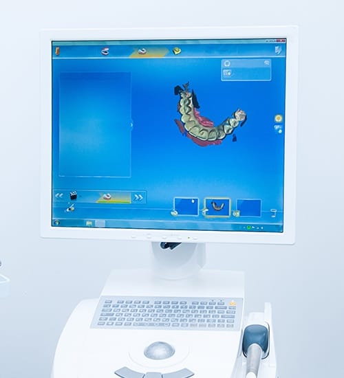 Digital smile imaging on dental office computer