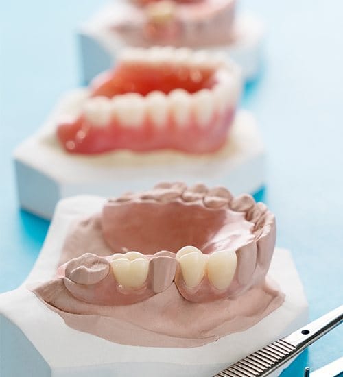 Smile models with samples of partial and full dentures