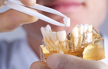 dentist placing a crown onto a dental implant