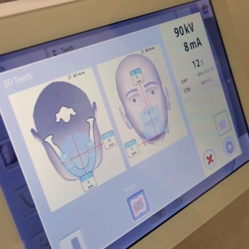 Screen on digital dental treatment planning technology
