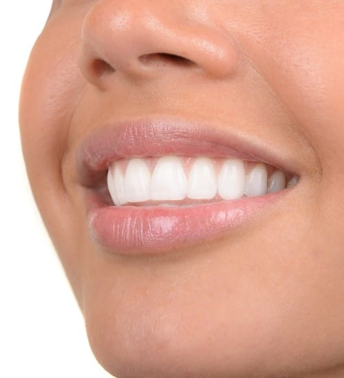 Healthy smile after gum disease treatment