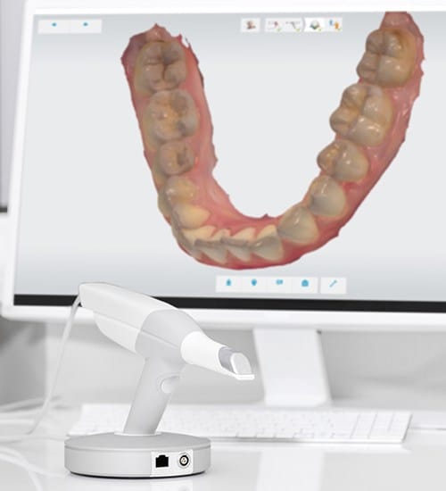 Digital smile impression on chairside computer