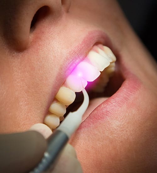 Patient receiving soft tissue laser dentistry treatment