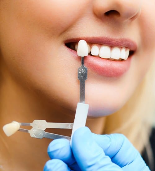 Woman's smile compared with porcelain veneer sample