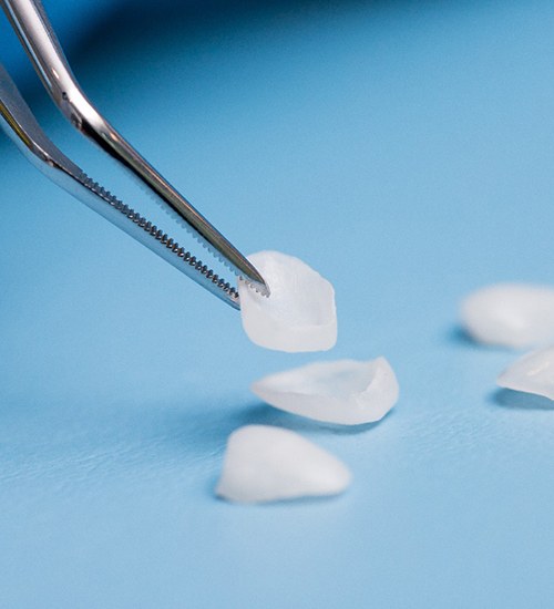 Close-up of veneers in San Ramon, CA being picked up 