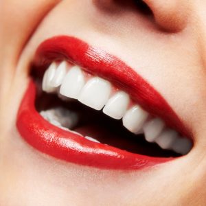 San Ramon Teeth Whitening