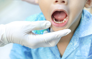 Child opening mouth for dentist to show tongue-tie